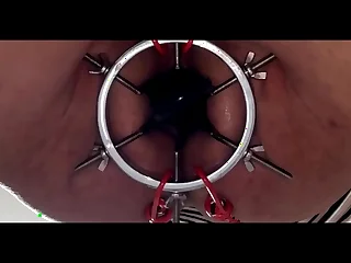 Open my hole with a octopus claw-Part 3- 35 cm long anal beads insertion